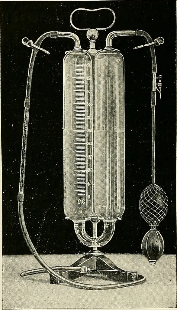 An illustration from Surgery of the lung / by C. Garrè and H. Quincke., 1913, leaf 188