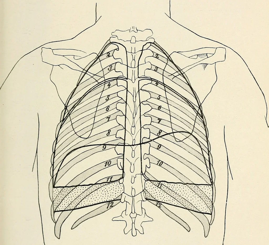 An illustration from Surgery of the lung / by C. Garrè and H. Quincke., 1913, leaf 21