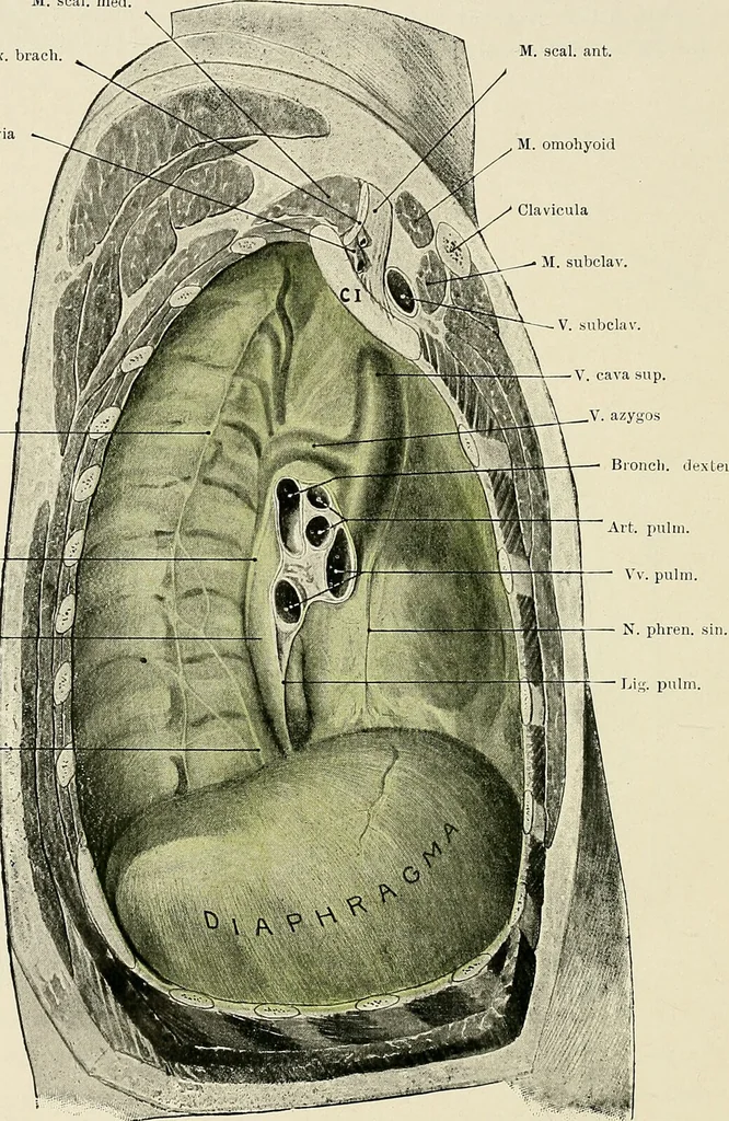 An illustration from Surgery of the lung / by C. Garrè and H. Quincke., 1913, leaf 22