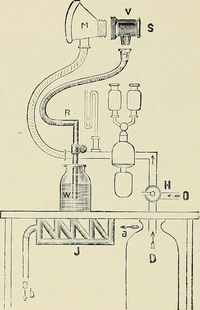 An illustration from Surgery of the lung / by C. Garrè and H. Quincke., 1913, leaf 60