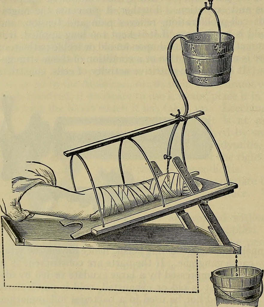 An illustration from Modern surgery, general and operative / by John Chalmers DaCosta., 1914, leaf 100