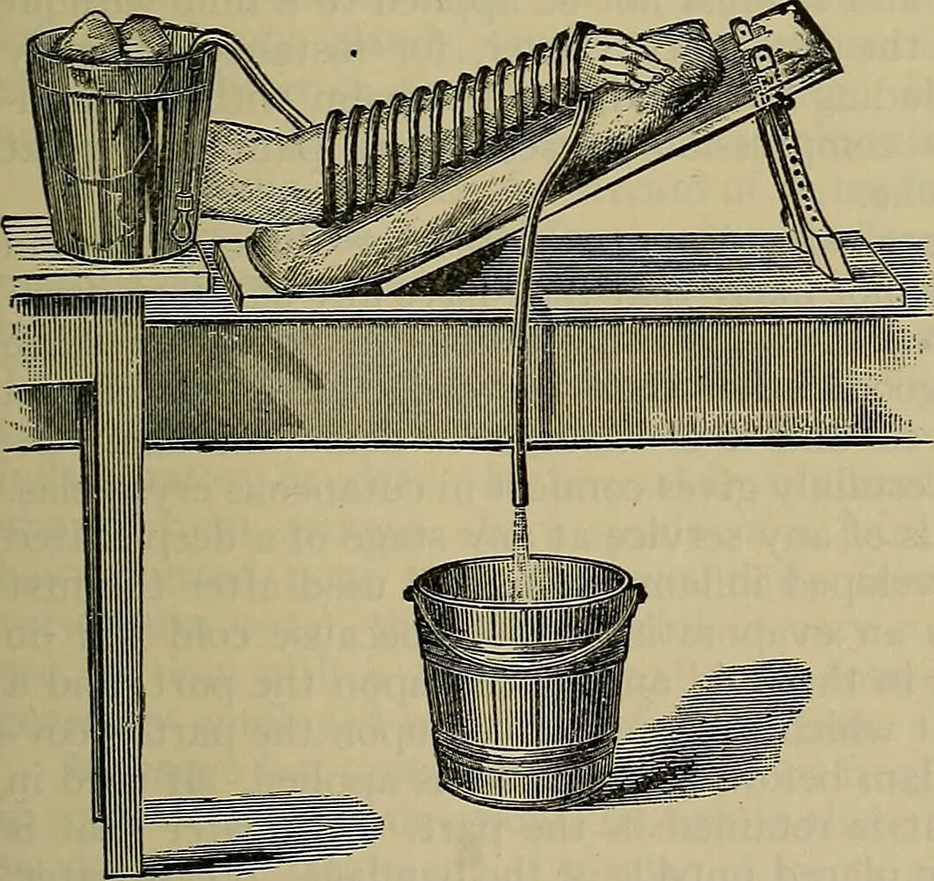 An illustration from Modern surgery, general and operative / by John Chalmers DaCosta., 1914, leaf 101