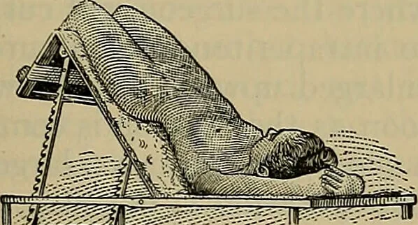An illustration from Modern surgery, general and operative / by John Chalmers DaCosta., 1914, leaf 1093