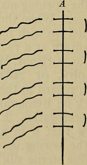 An illustration from Modern surgery, general and operative / by John Chalmers DaCosta., 1914, leaf 1104