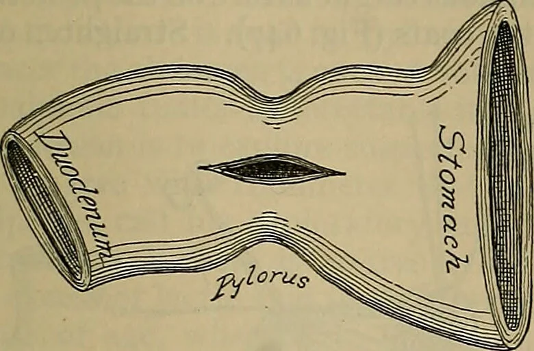 An illustration from Modern surgery, general and operative / by John Chalmers DaCosta., 1914, leaf 1111
