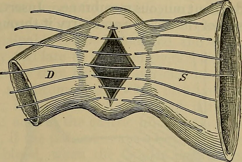An illustration from Modern surgery, general and operative / by John Chalmers DaCosta., 1914, leaf 1111