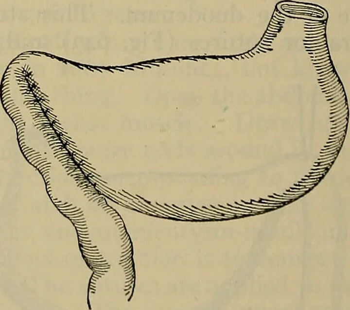 An illustration from Modern surgery, general and operative / by John Chalmers DaCosta., 1914, leaf 1112