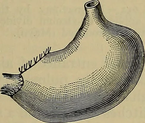 An illustration from Modern surgery, general and operative / by John Chalmers DaCosta., 1914, leaf 1113