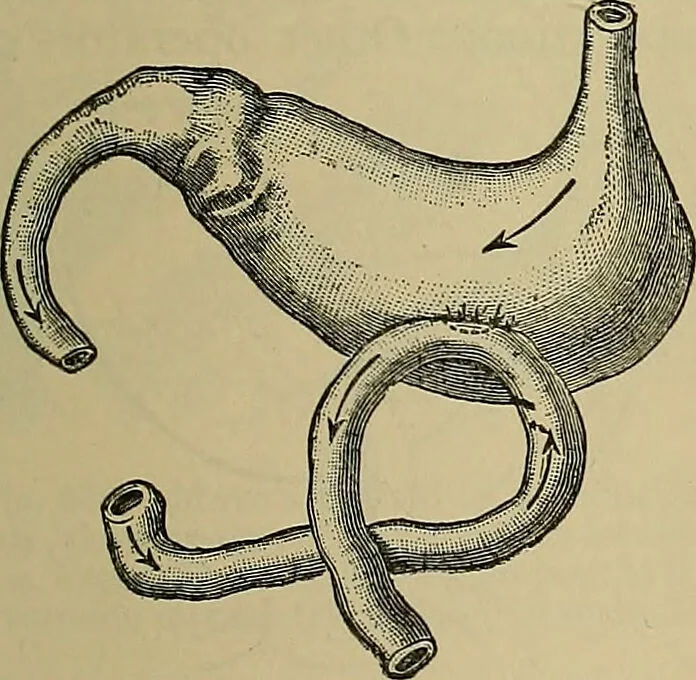 An illustration from Modern surgery, general and operative / by John Chalmers DaCosta., 1914, leaf 1121