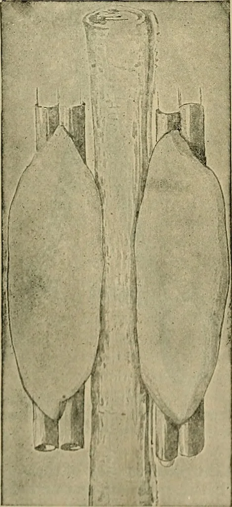 An illustration from Modern surgery, general and operative / by John Chalmers DaCosta., 1914, leaf 1128