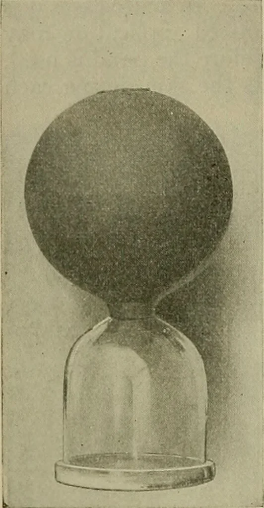 An illustration from Modern surgery, general and operative / by John Chalmers DaCosta., 1914, leaf 116