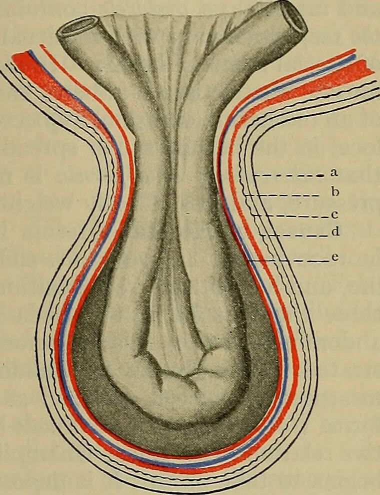 An illustration from Modern surgery, general and operative / by John Chalmers DaCosta., 1914, leaf 1171