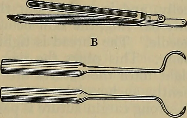 An illustration from Modern surgery, general and operative / by John Chalmers DaCosta., 1914, leaf 1185