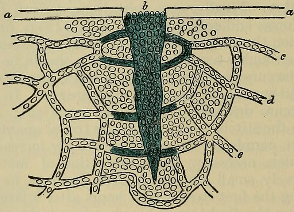 An illustration from Modern surgery, general and operative / by John Chalmers DaCosta., 1914, leaf 120