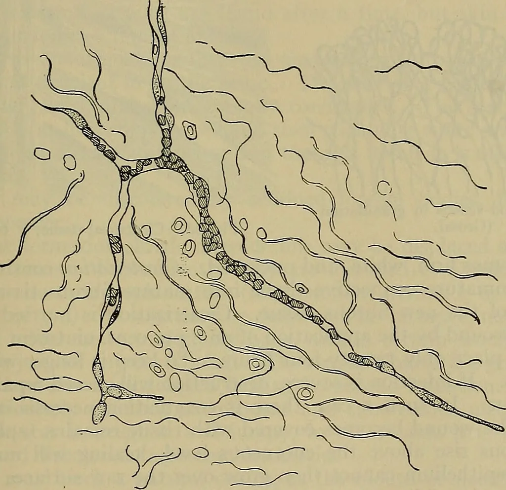 An illustration from Modern surgery, general and operative / by John Chalmers DaCosta., 1914, leaf 121