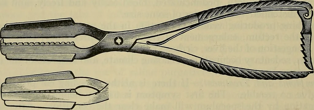 An illustration from Modern surgery, general and operative / by John Chalmers DaCosta., 1914, leaf 1226