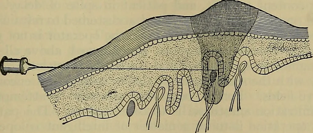 An illustration from Modern surgery, general and operative / by John Chalmers DaCosta., 1914, leaf 1265