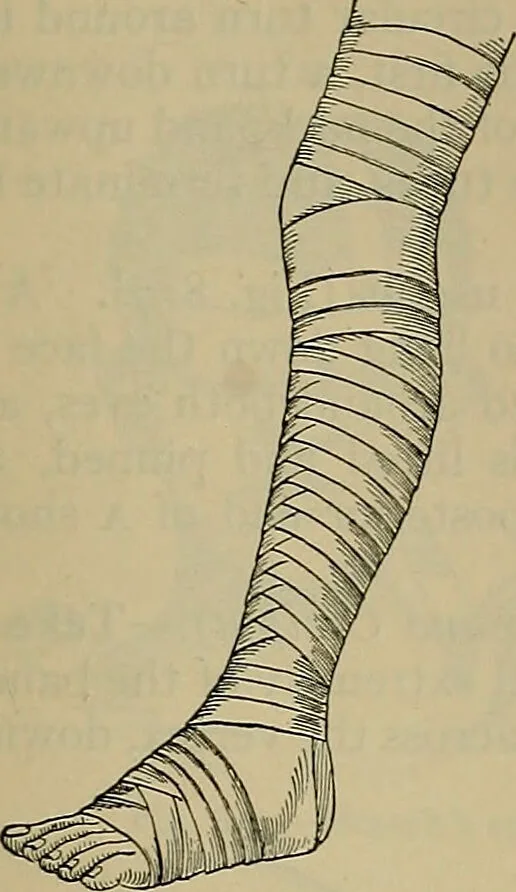An illustration from Modern surgery, general and operative / by John Chalmers DaCosta., 1914, leaf 1301