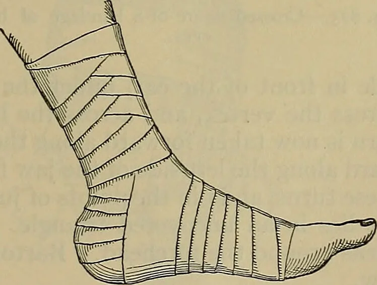 An illustration from Modern surgery, general and operative / by John Chalmers DaCosta., 1914, leaf 1301