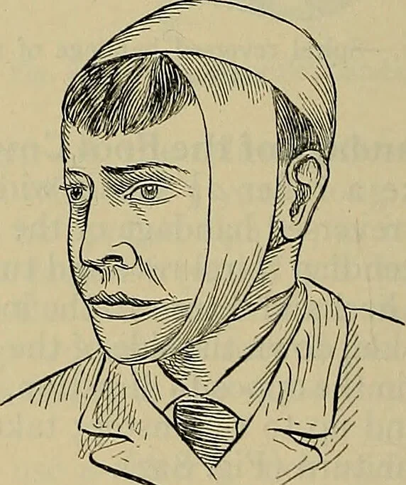 An illustration from Modern surgery, general and operative / by John Chalmers DaCosta., 1914, leaf 1302