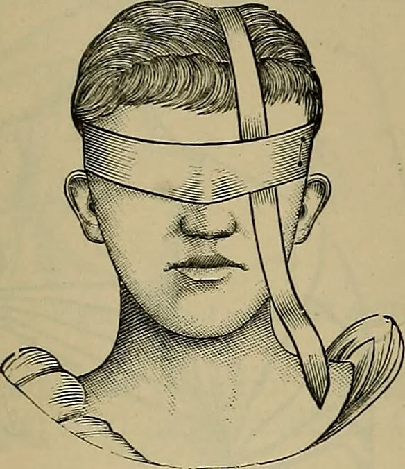 An illustration from Modern surgery, general and operative / by John Chalmers DaCosta., 1914, leaf 1303