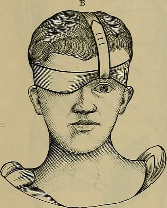 An illustration from Modern surgery, general and operative / by John Chalmers DaCosta., 1914, leaf 1303