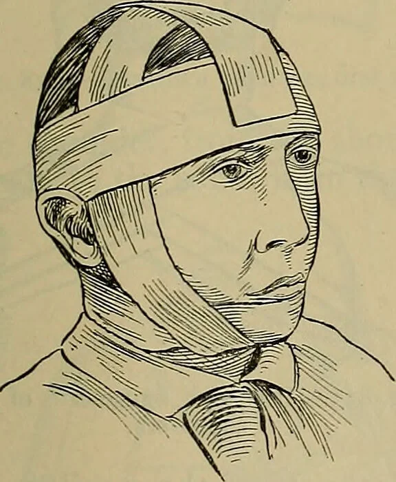 An illustration from Modern surgery, general and operative / by John Chalmers DaCosta., 1914, leaf 1303
