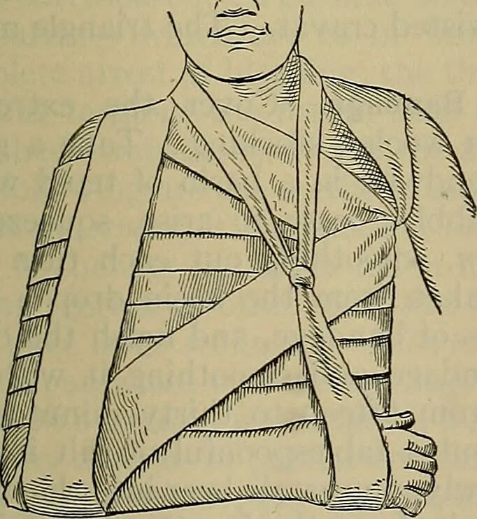 An illustration from Modern surgery, general and operative / by John Chalmers DaCosta., 1914, leaf 1305