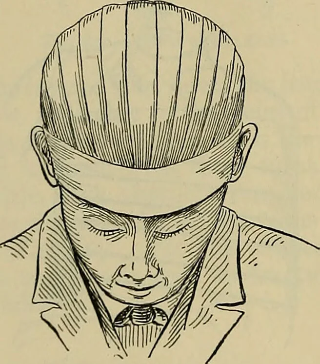 An illustration from Modern surgery, general and operative / by John Chalmers DaCosta., 1914, leaf 1306