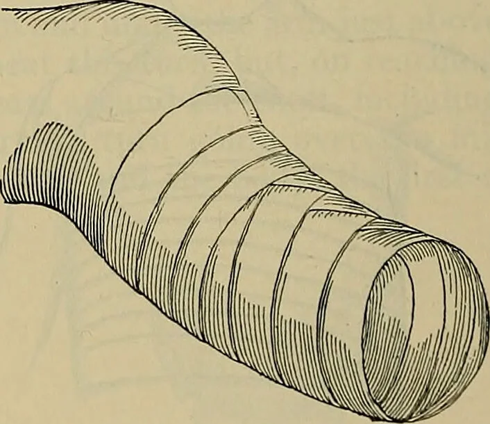 An illustration from Modern surgery, general and operative / by John Chalmers DaCosta., 1914, leaf 1306
