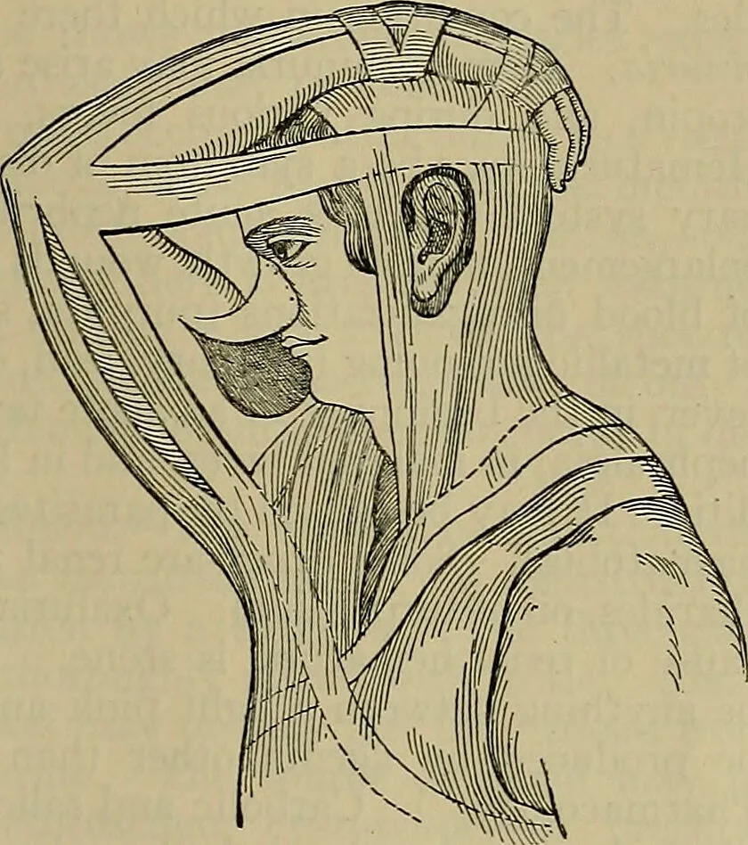 An illustration from Modern surgery, general and operative / by John Chalmers DaCosta., 1914, leaf 1311