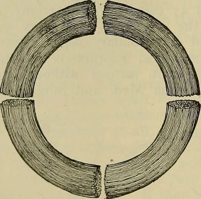 An illustration from Modern surgery, general and operative / by John Chalmers DaCosta., 1914, leaf 1328