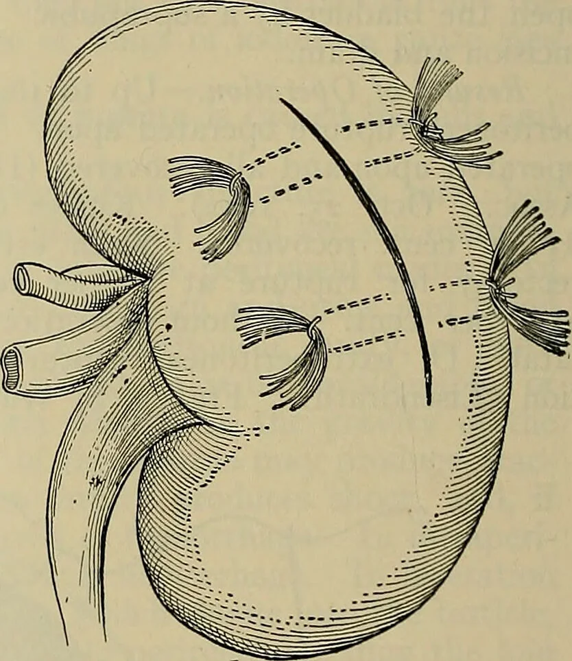 An illustration from Modern surgery, general and operative / by John Chalmers DaCosta., 1914, leaf 1328