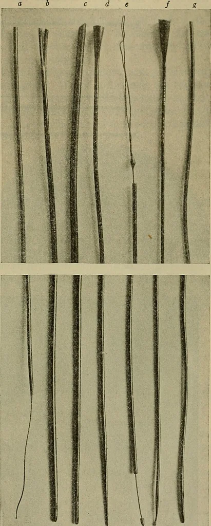 An illustration from Modern surgery, general and operative / by John Chalmers DaCosta., 1914, leaf 1349