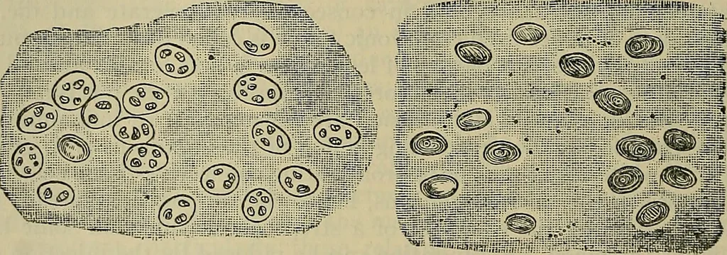 An illustration from Modern surgery, general and operative / by John Chalmers DaCosta., 1914, leaf 136