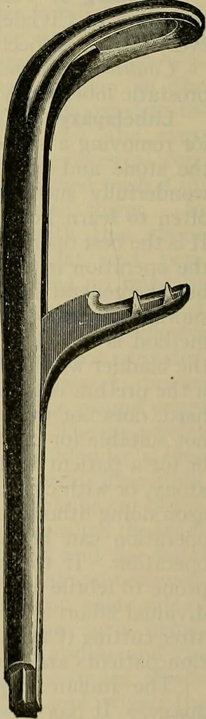 An illustration from Modern surgery, general and operative / by John Chalmers DaCosta., 1914, leaf 1380