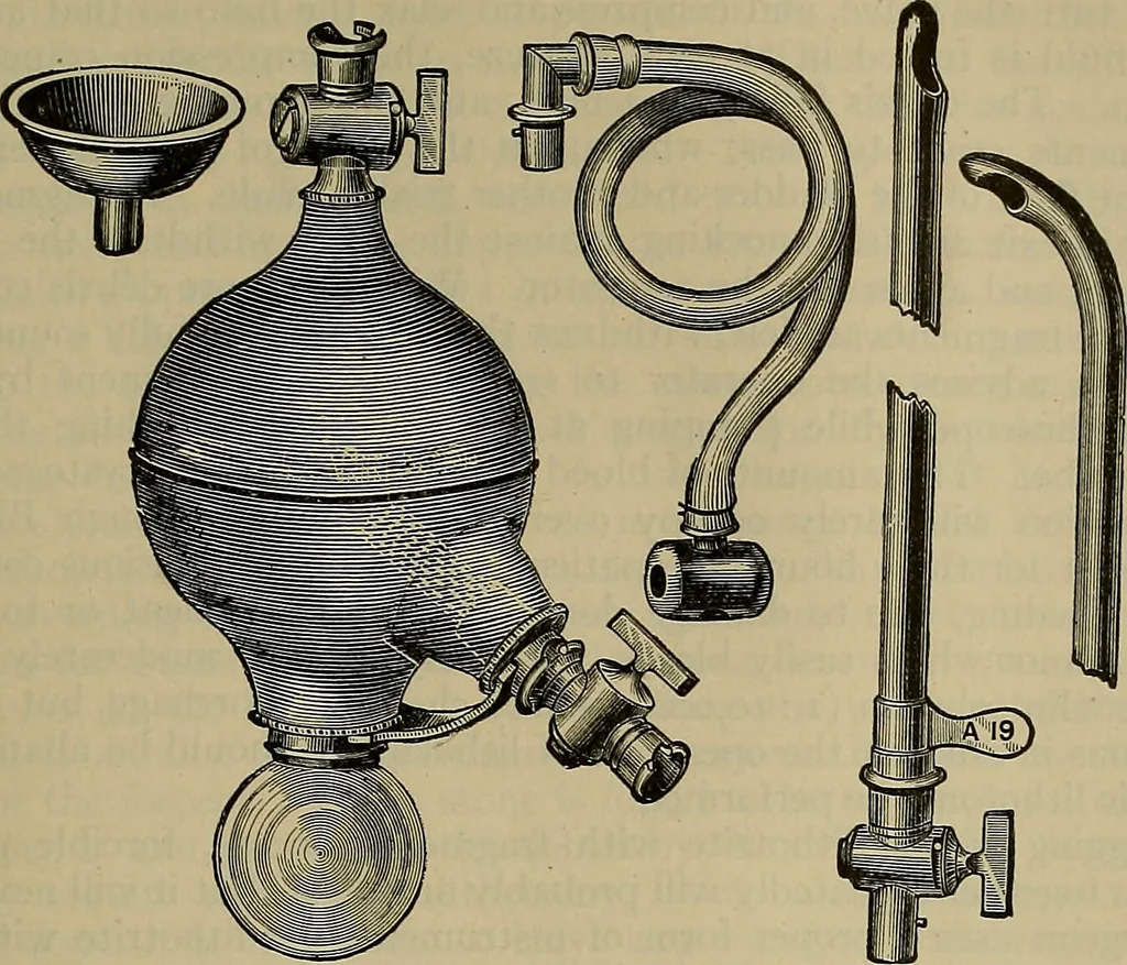 An illustration from Modern surgery, general and operative / by John Chalmers DaCosta., 1914, leaf 1381