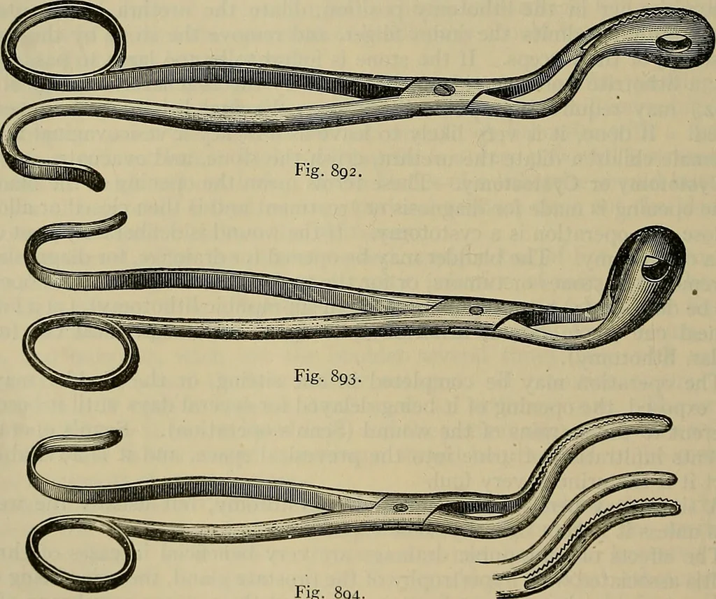 An illustration from Modern surgery, general and operative / by John Chalmers DaCosta., 1914, leaf 1384