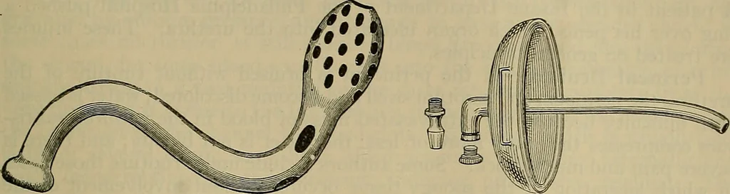 An illustration from Modern surgery, general and operative / by John Chalmers DaCosta., 1914, leaf 1385