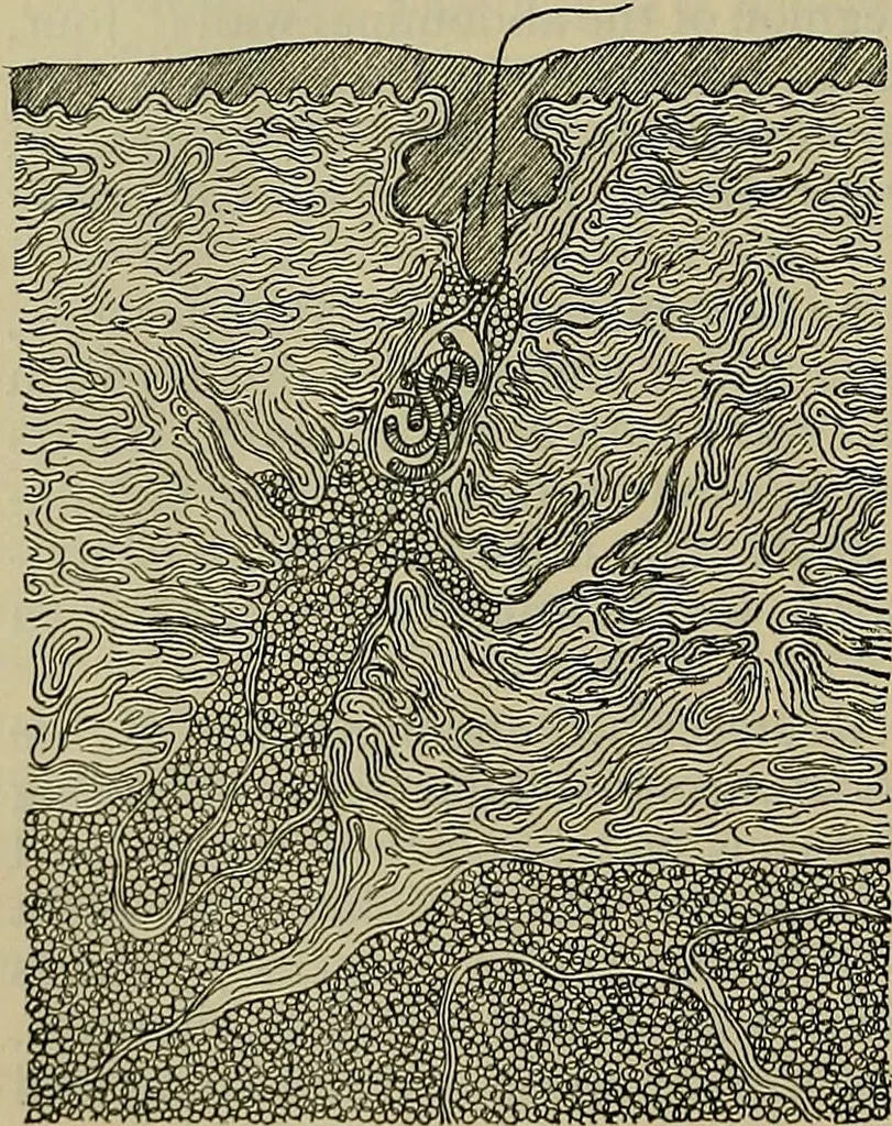 An illustration from Modern surgery, general and operative / by John Chalmers DaCosta., 1914, leaf 140