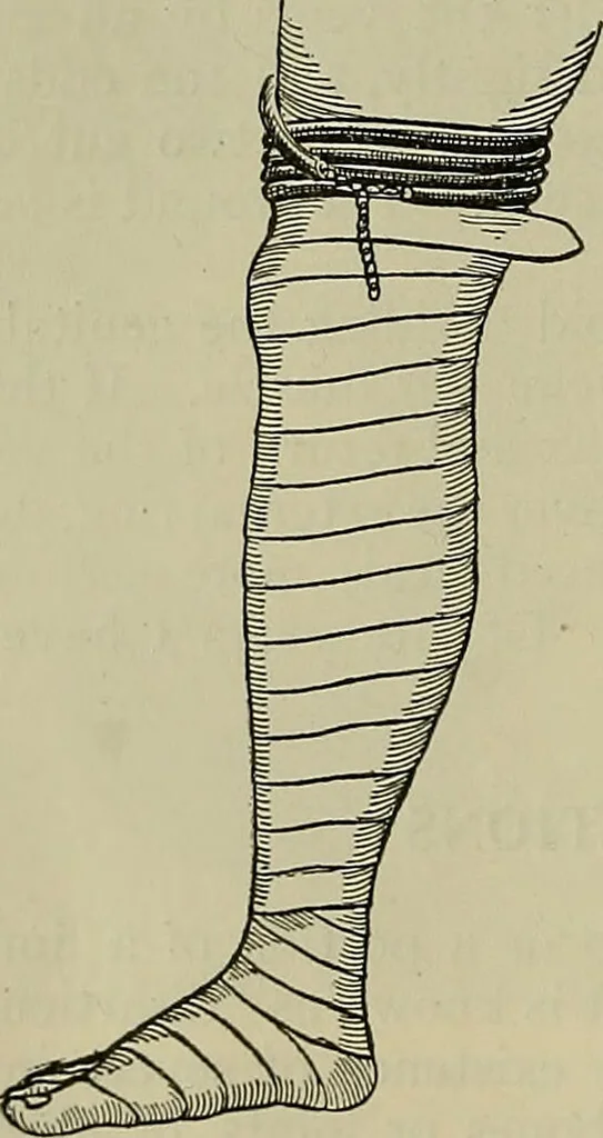 An illustration from Modern surgery, general and operative / by John Chalmers DaCosta., 1914, leaf 1448