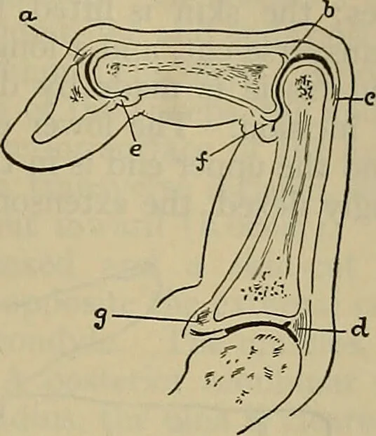 An illustration from Modern surgery, general and operative / by John Chalmers DaCosta., 1914, leaf 1453