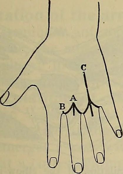 An illustration from Modern surgery, general and operative / by John Chalmers DaCosta., 1914, leaf 1453