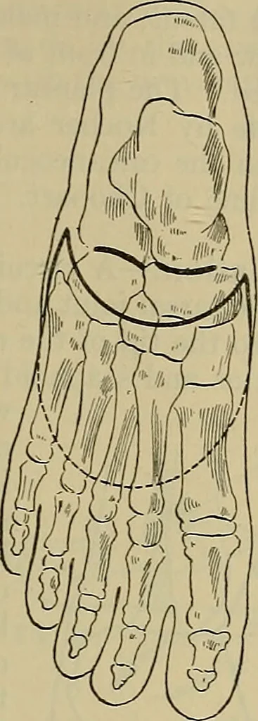 An illustration from Modern surgery, general and operative / by John Chalmers DaCosta., 1914, leaf 1459
