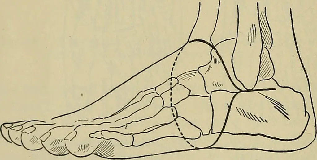 An illustration from Modern surgery, general and operative / by John Chalmers DaCosta., 1914, leaf 1460