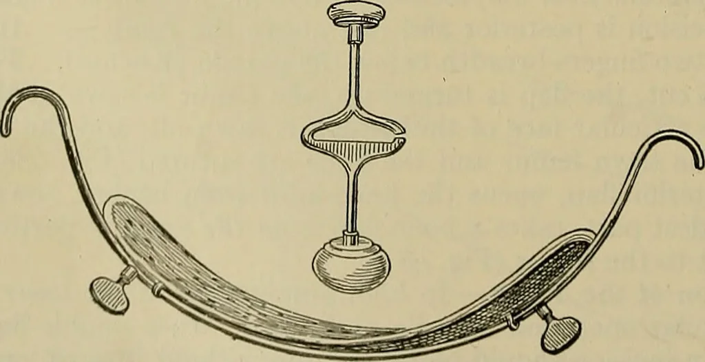 An illustration from Modern surgery, general and operative / by John Chalmers DaCosta., 1914, leaf 1464