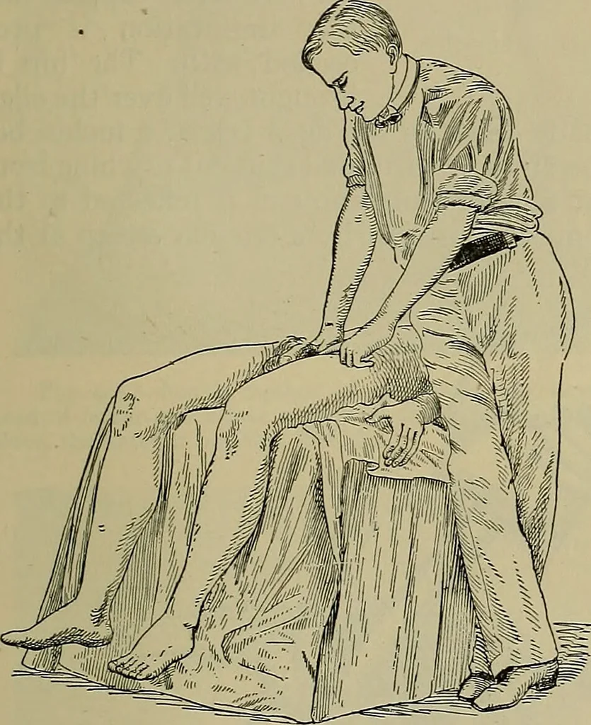 An illustration from Modern surgery, general and operative / by John Chalmers DaCosta., 1914, leaf 1465