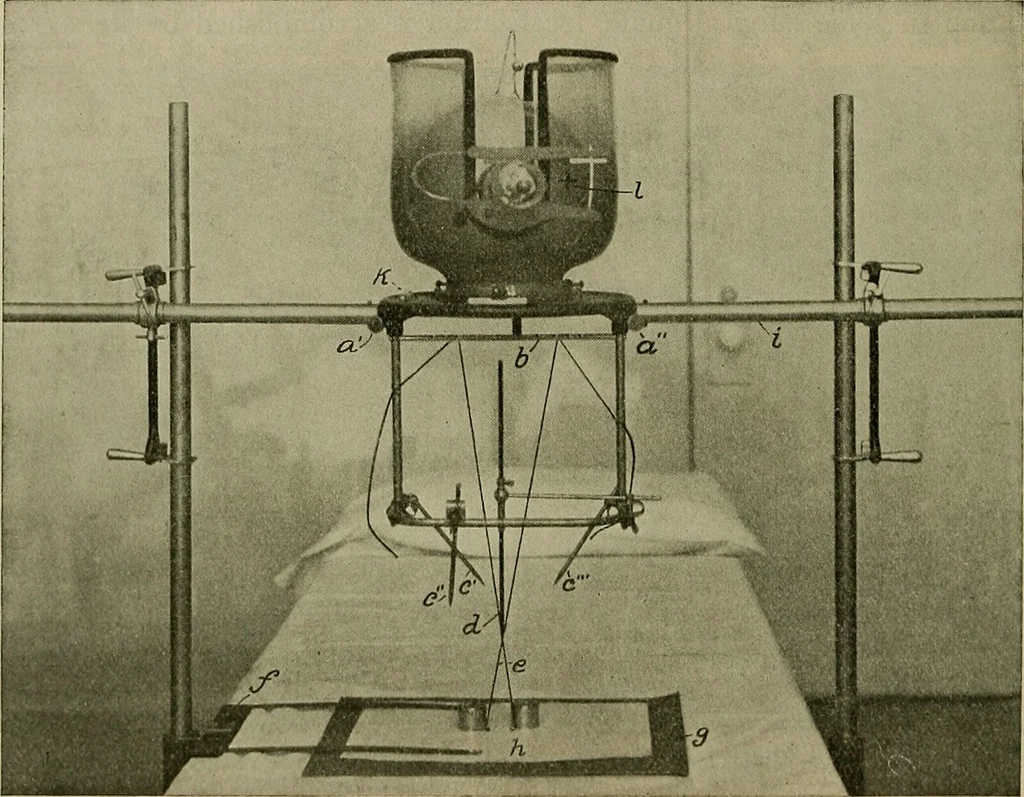 An illustration from Modern surgery, general and operative / by John Chalmers DaCosta., 1914, leaf 1508