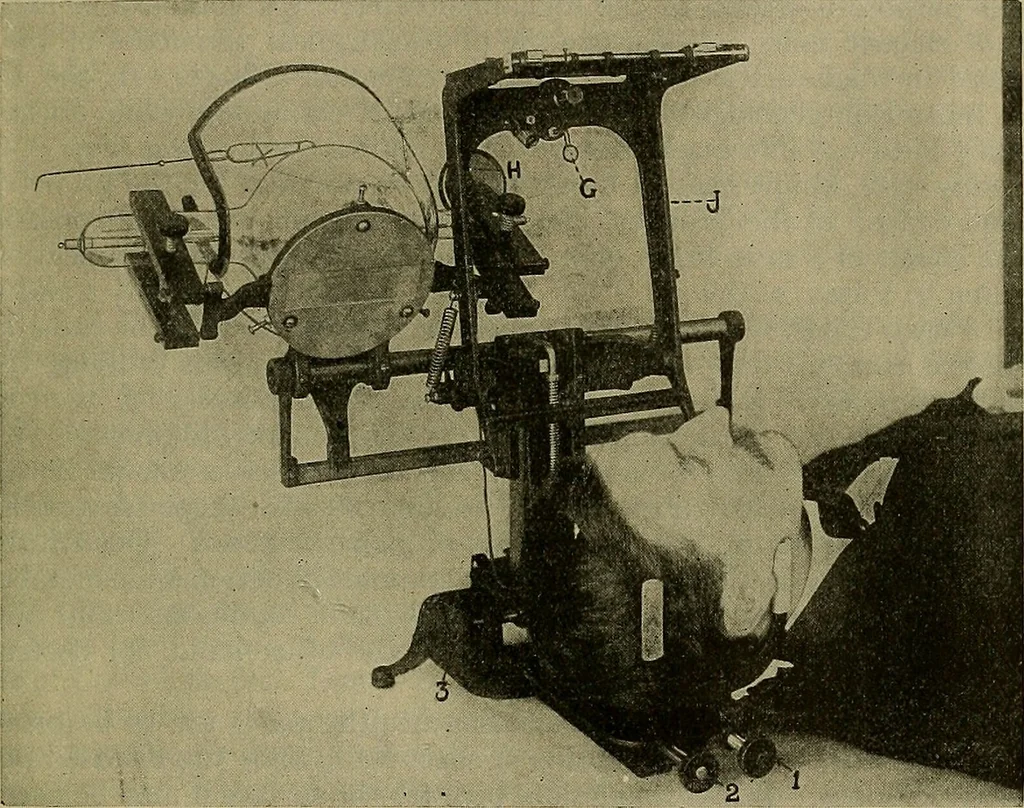 An illustration from Modern surgery, general and operative / by John Chalmers DaCosta., 1914, leaf 1511