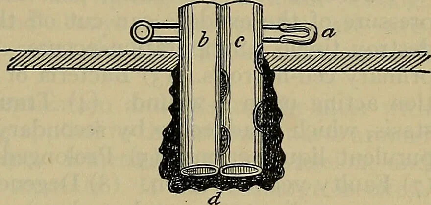 An illustration from Modern surgery, general and operative / by John Chalmers DaCosta., 1914, leaf 153